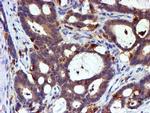 LIMK1 Antibody in Immunohistochemistry (Paraffin) (IHC (P))