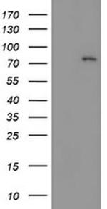 LIMK1 Antibody in Western Blot (WB)