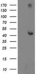 AP2M1 Antibody in Western Blot (WB)