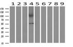 AP2M1 Antibody in Western Blot (WB)