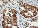 PDXK Antibody in Immunohistochemistry (Paraffin) (IHC (P))