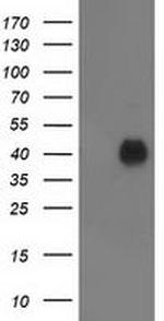 PDXK Antibody in Western Blot (WB)