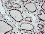 Monoacylglycerol Lipase Antibody in Immunohistochemistry (Paraffin) (IHC (P))