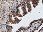 ILVBL Antibody in Immunohistochemistry (Paraffin) (IHC (P))