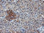 ILVBL Antibody in Immunohistochemistry (Paraffin) (IHC (P))