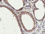 ILVBL Antibody in Immunohistochemistry (Paraffin) (IHC (P))