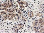 ILVBL Antibody in Immunohistochemistry (Paraffin) (IHC (P))