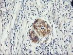 ILVBL Antibody in Immunohistochemistry (Paraffin) (IHC (P))