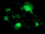 SMS Antibody in Immunocytochemistry (ICC/IF)