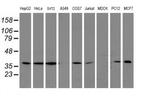 LCMT1 Antibody in Western Blot (WB)