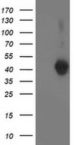 LCMT1 Antibody in Western Blot (WB)