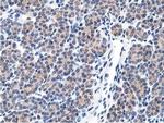 LCMT1 Antibody in Immunohistochemistry (Paraffin) (IHC (P))