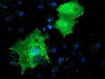 LMCD1 Antibody in Immunocytochemistry (ICC/IF)