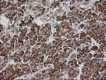 GATM Antibody in Immunohistochemistry (Paraffin) (IHC (P))