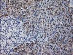 GATM Antibody in Immunohistochemistry (Paraffin) (IHC (P))