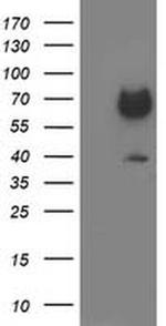 GATM Antibody in Western Blot (WB)