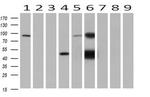 GATM Antibody in Western Blot (WB)