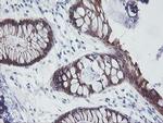 IRF6 Antibody in Immunohistochemistry (Paraffin) (IHC (P))