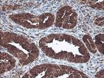 CNDP2 Antibody in Immunohistochemistry (Paraffin) (IHC (P))