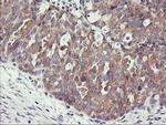 PHF21B Antibody in Immunohistochemistry (Paraffin) (IHC (P))