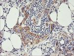 PHF21B Antibody in Immunohistochemistry (Paraffin) (IHC (P))