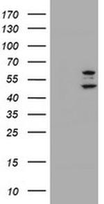 PHF21B Antibody in Western Blot (WB)