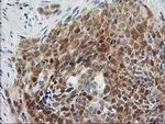 OSBP Antibody in Immunohistochemistry (Paraffin) (IHC (P))