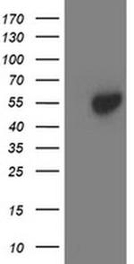 Aminoacylase Antibody in Western Blot (WB)