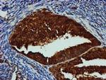 GATM Antibody in Immunohistochemistry (Paraffin) (IHC (P))