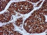 GATM Antibody in Immunohistochemistry (Paraffin) (IHC (P))