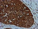 GATM Antibody in Immunohistochemistry (Paraffin) (IHC (P))