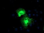 PSMD2 Antibody in Immunocytochemistry (ICC/IF)