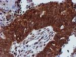 PSMD2 Antibody in Immunohistochemistry (Paraffin) (IHC (P))