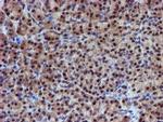 PSMD2 Antibody in Immunohistochemistry (Paraffin) (IHC (P))