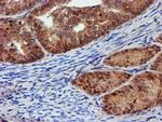 PSMD2 Antibody in Immunohistochemistry (Paraffin) (IHC (P))