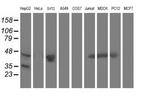 Aminoacylase Antibody in Western Blot (WB)