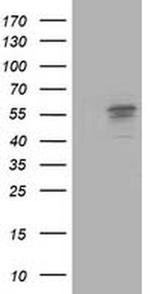 ALDH3A2 Antibody in Western Blot (WB)