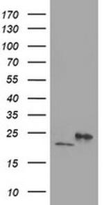 DHFRL1 Antibody in Western Blot (WB)