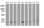 DHFRL1 Antibody in Western Blot (WB)