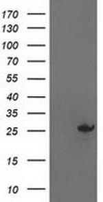 Adenylate Kinase 4 Antibody in Western Blot (WB)