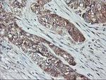 PTP1B Antibody in Immunohistochemistry (Paraffin) (IHC (P))