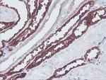 MCAK Antibody in Immunohistochemistry (Paraffin) (IHC (P))