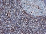 MCAK Antibody in Immunohistochemistry (Paraffin) (IHC (P))