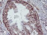 MCAK Antibody in Immunohistochemistry (Paraffin) (IHC (P))