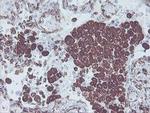 MCAK Antibody in Immunohistochemistry (Paraffin) (IHC (P))