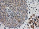 BAIAP2 Antibody in Immunohistochemistry (Paraffin) (IHC (P))