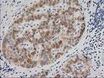 BAIAP2 Antibody in Immunohistochemistry (Paraffin) (IHC (P))