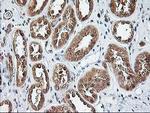 NUDT9 Antibody in Immunohistochemistry (Paraffin) (IHC (P))