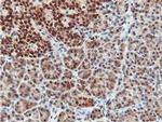 CoA Synthase Antibody in Immunohistochemistry (Paraffin) (IHC (P))