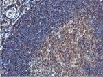 CoA Synthase Antibody in Immunohistochemistry (Paraffin) (IHC (P))